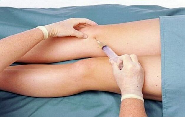 Mức độ khớp của khớp gối