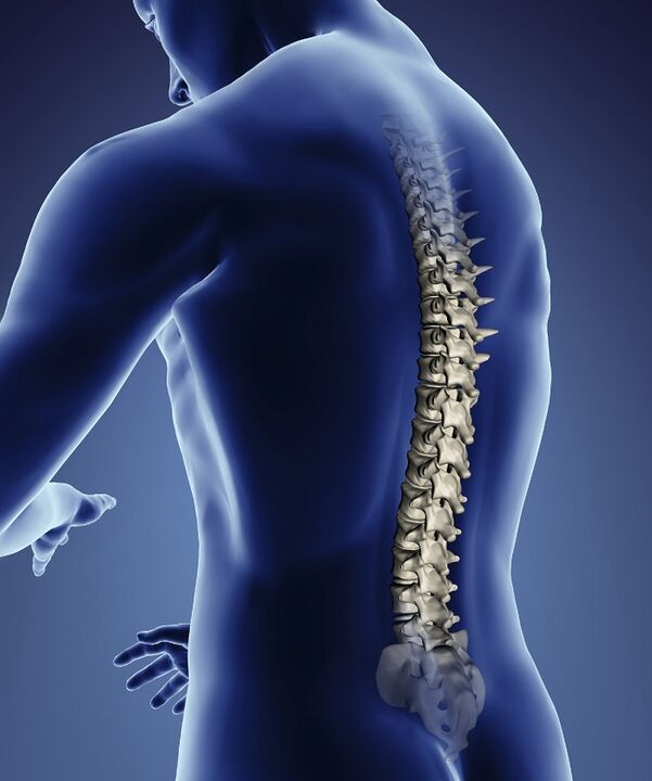 dây thần kinh bị chèn ép ở cột sống với chứng hoại tử xương